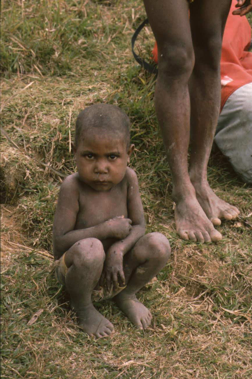 BD/166/344 -
Squating Papua child
