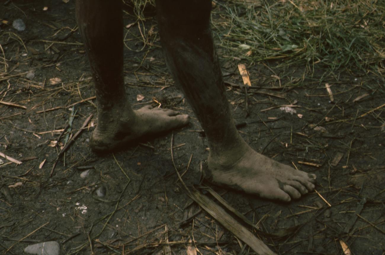 BD/166/383 -
A Papua man's feet
