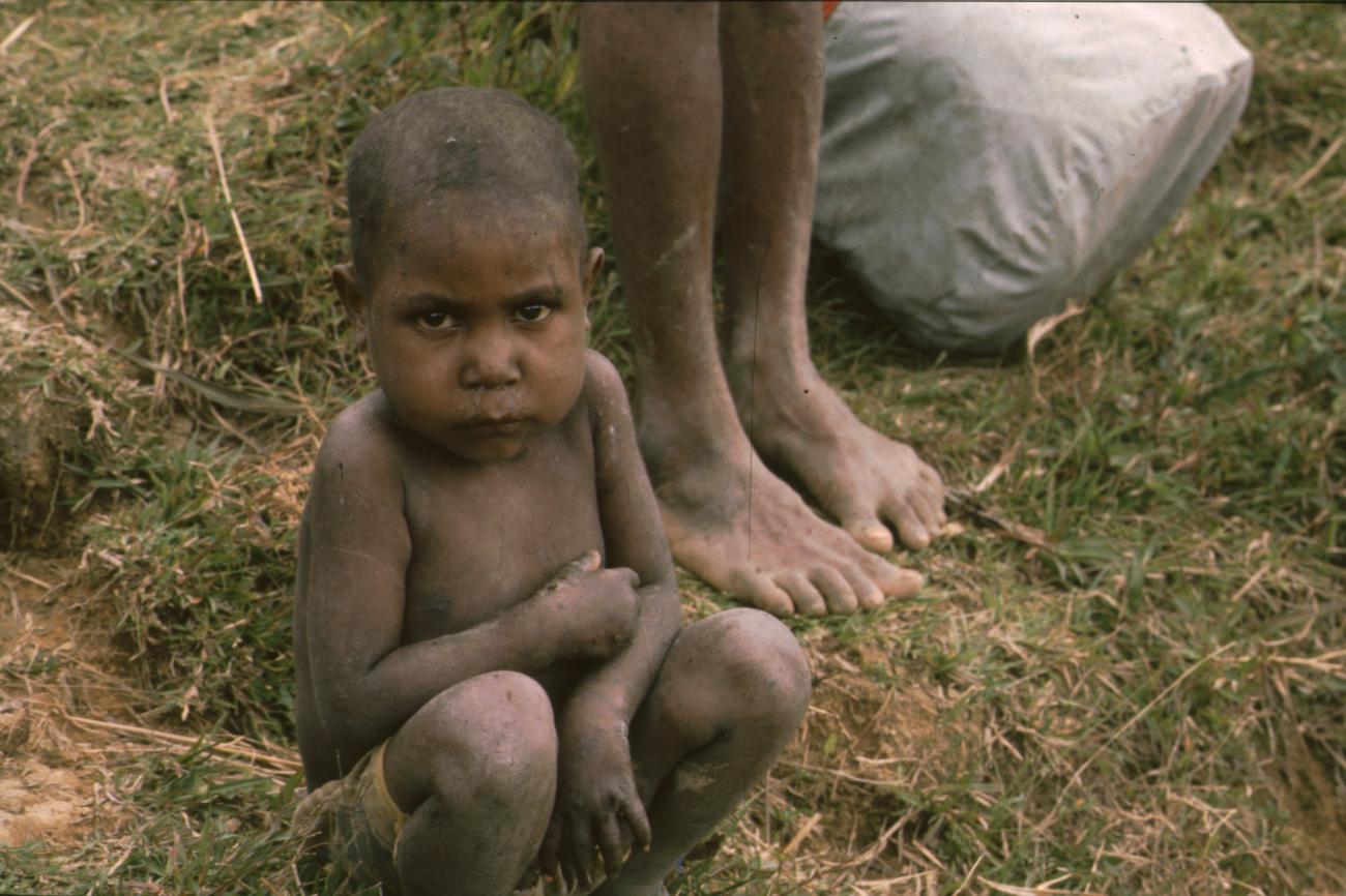 BD/166/89 -
Toddler squatting in the grass