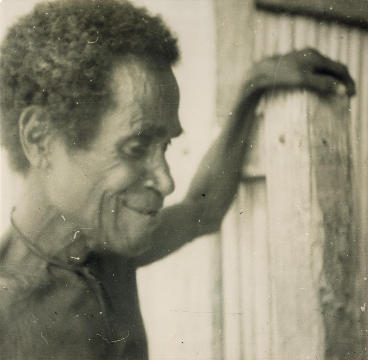 BD/309/26 - 
Dorp Sisir, man kijkt toe terwijl meisje been met aandoening toont
