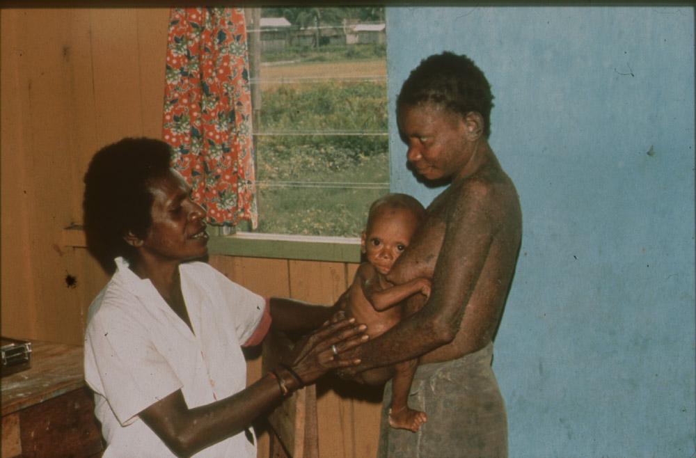 BD/30/81 - 
Asmat nurse examines the baby of a young woman at the medical center
